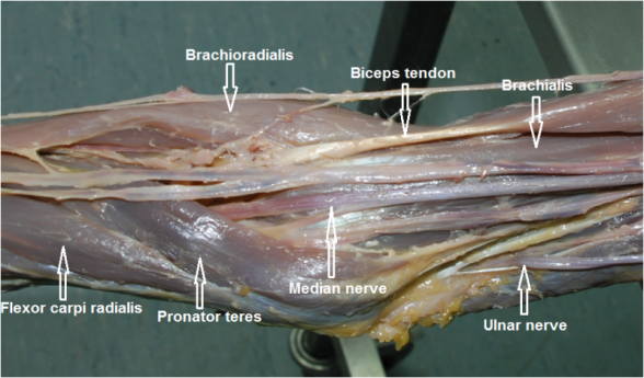 Cubital Fossa Anatomy Of The Upper Limb